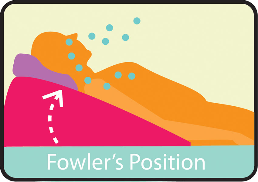 Fowlers Position